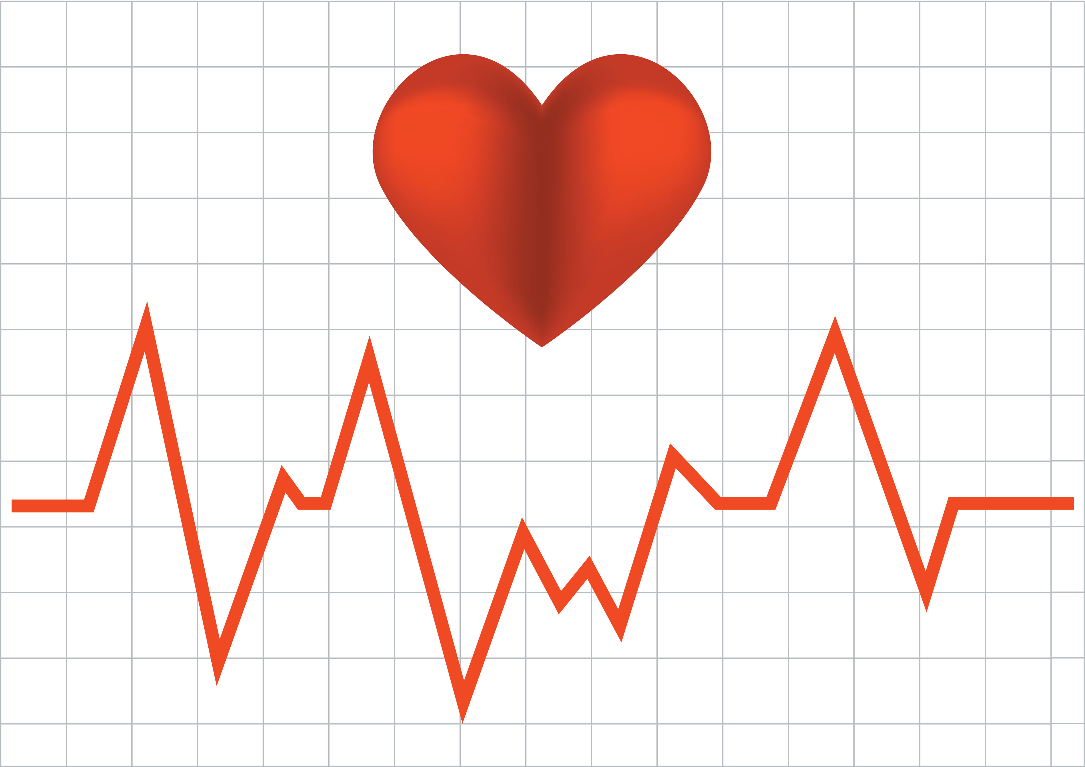 Сердцебиение остановилось. Диаграмма сердца. Сердцебиение картинка. Диаграмма сердцебиения. Пульс рисунок.